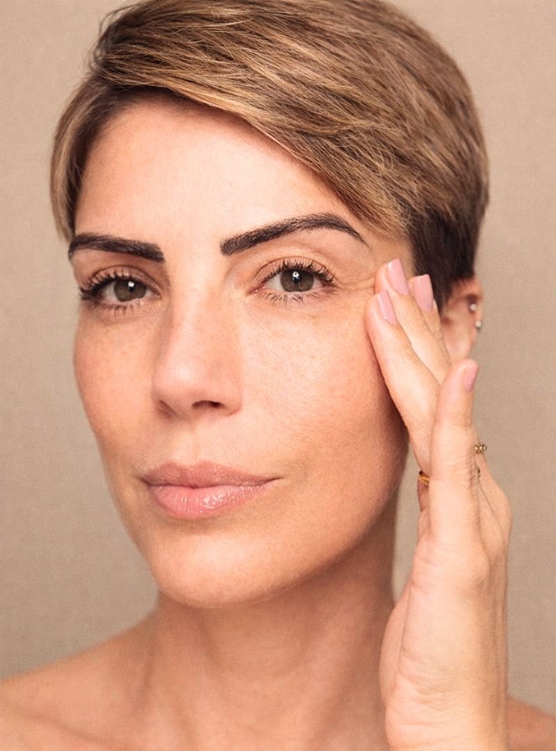 Bioestimulador e fio de tração - Protocolo combinado Dra Silvia